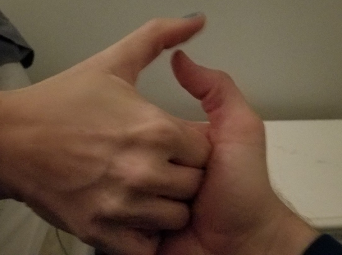 Thumb War by Andrew Fernlund have a thumb war